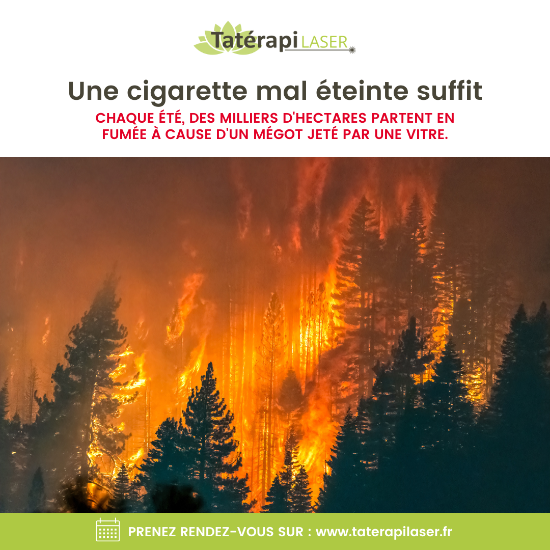 Tatérapi Laser Genève